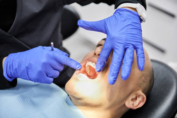 Best Emergency Dental Surgery in Snellville, GA