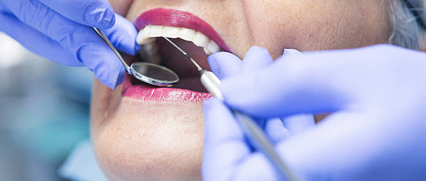 Best Emergency Tooth Extraction in Snellville, GA