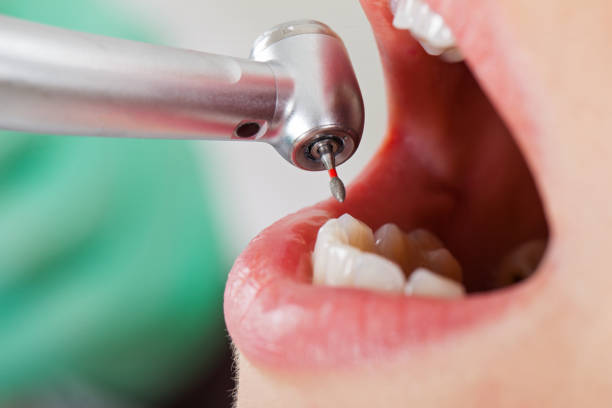 Best Weekend Emergency Dentist in Snellville, GA